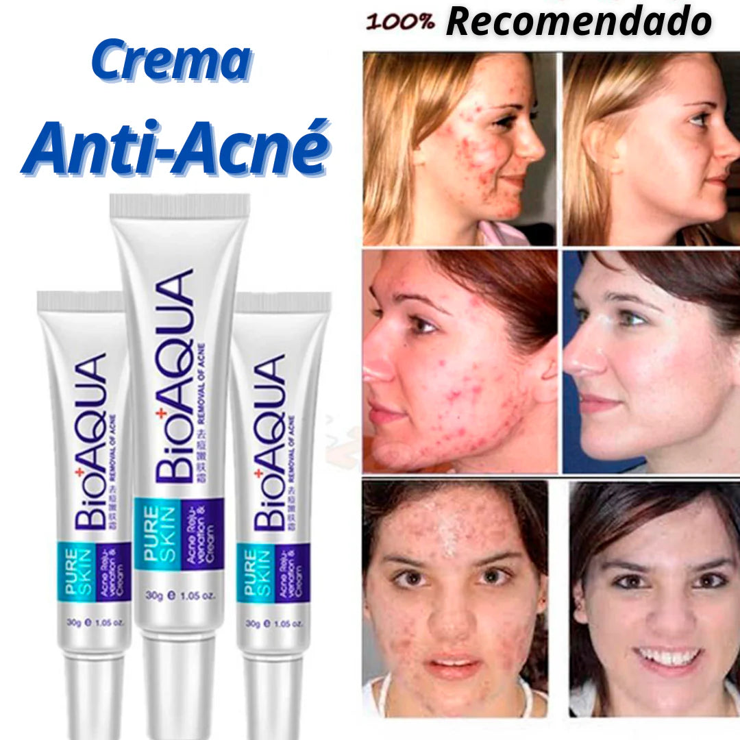 Combo Facial Antiacne®  BIOAQUA X4